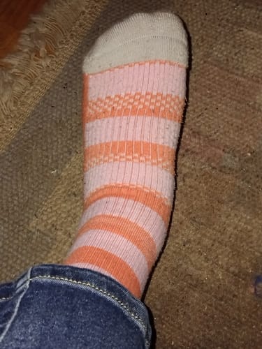 Customer's Diasocks Stödstrumpor featuring soft, peach and white striped patterns worn on a person's foot.